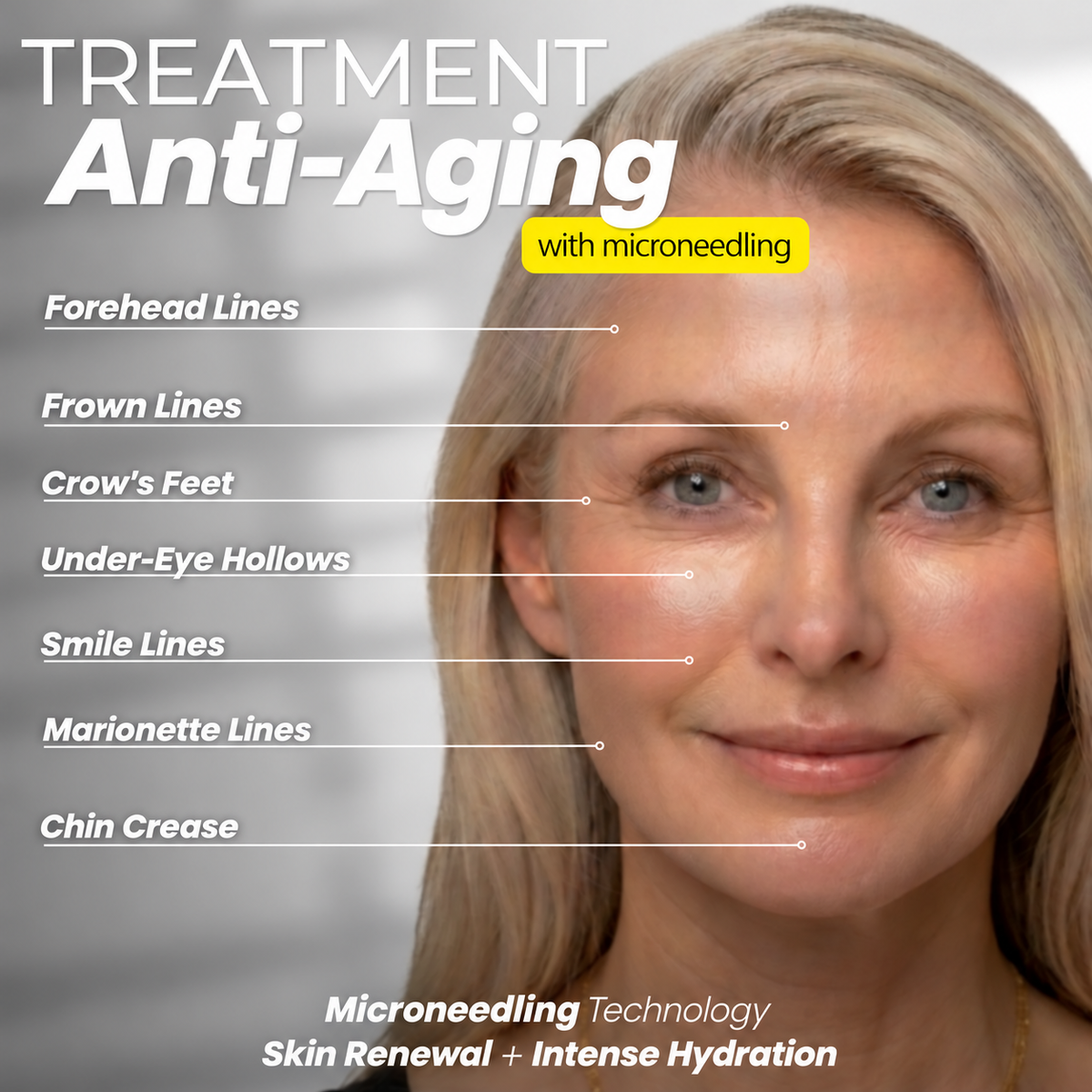Fine Lines & Wrinkles Kit — Aqua Stamp + Hyaluronic Acid Serum
