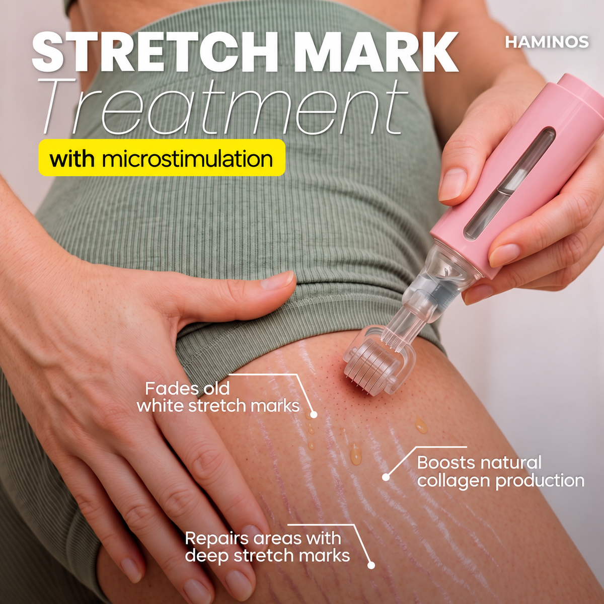 Stretch Marks Kit — Derma Roller + Hyaluronic Acid Serum