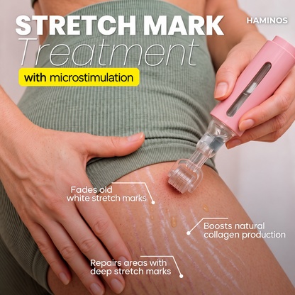 Stretch Marks Kit — Derma Roller + Hyaluronic Acid Serum