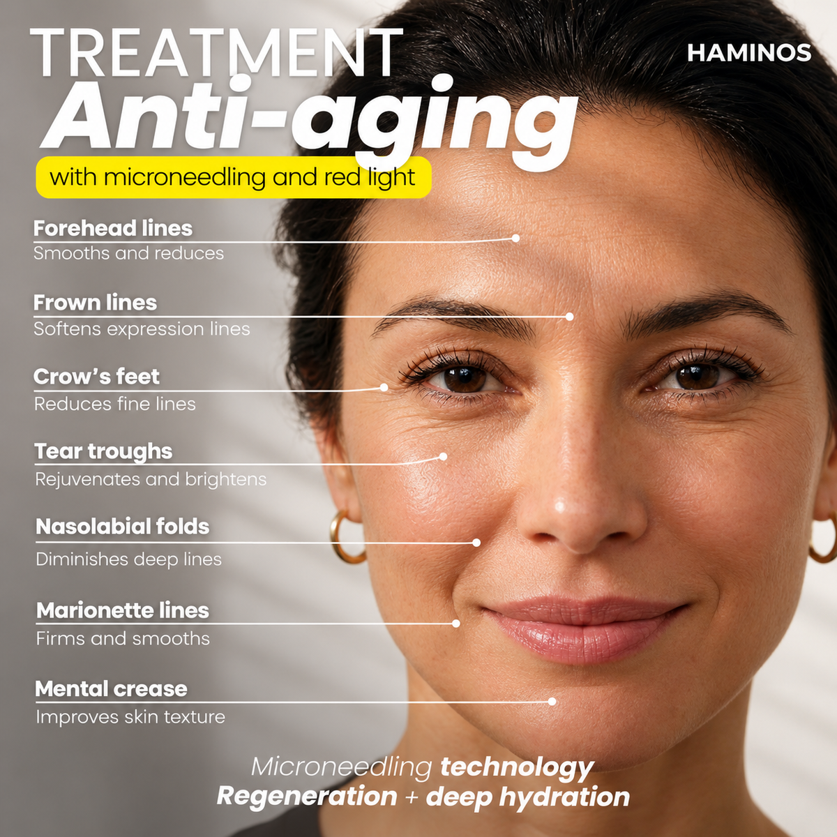 Anti-Aging & Wrinkle Kit — Derma Stamp 4-in-1 + Hyaluronic Acid Serum