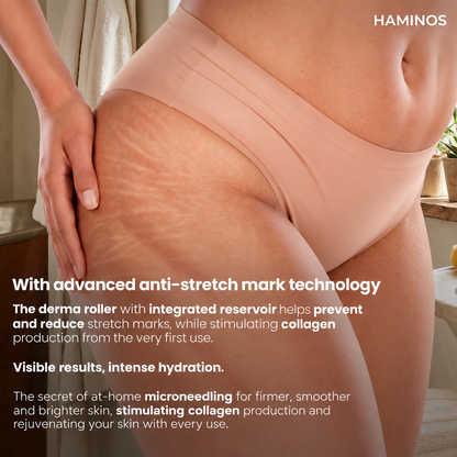 Stretch Marks Kit — Derma Roller + Hyaluronic Acid Serum