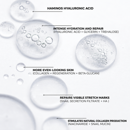 Stretch Marks Kit — Derma Roller + Hyaluronic Acid Serum
