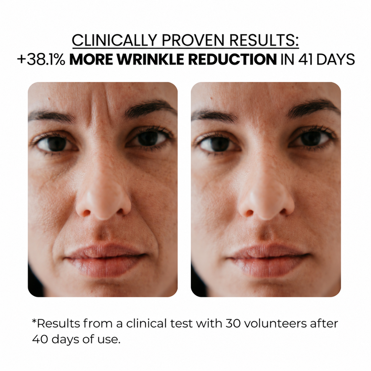 Anti-Aging Kit — Derma Roller + Hyaluronic Acid Serum