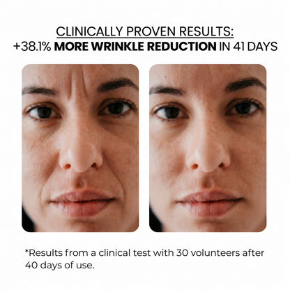 Anti-Aging Kit — Derma Roller + Hyaluronic Acid Serum
