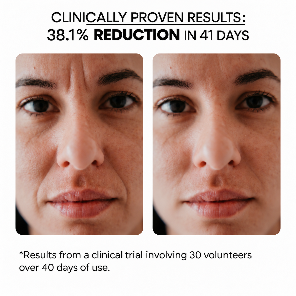 Fine Lines & Wrinkles Kit — Aqua Stamp + Hyaluronic Acid Serum