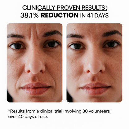 Fine Lines & Wrinkles Kit — Aqua Stamp + Hyaluronic Acid Serum